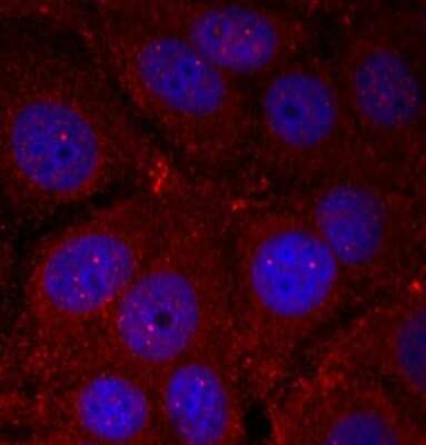 Immunocytochemistry/Immunofluorescence: alpha-Synuclein [p Tyr136] Antibody [NBP3-05404] - Immunofluorescence analysis of methanol-fixed HeLa cells using alpha-Synuclein antibody (NBP3-05404).